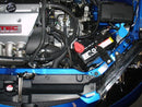 Injen SP Series Cold Air Intake – 2002-2006 Acura RSX - Black
