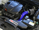 HPS Performance Performance Air Intake – 2011-2014 Hyundai Sonata / 2011-2015 Kia Optima | 827-267BL