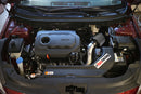 HPS Performance Performance Air Intake – 2015-2019 Hyundai Sonata / 2016-2020 Kia Optima | 827-549BL