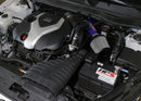HPS Performance Performance Air Intake – 2011-2014 Hyundai Sonata / 2011-2015 Kia Optima | 827-587BL