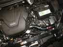 Injen SP Series Cold Air Intake – 2012 Kia Soul 1.6L - Black
