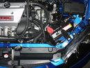 Injen SP Series Cold Air Intake – 2002-2006 Acura RSX - Polished